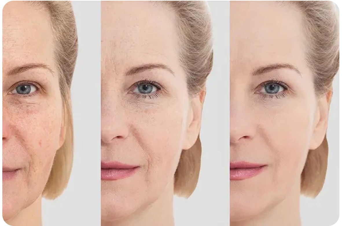 Masajeador facial anti arrugas
